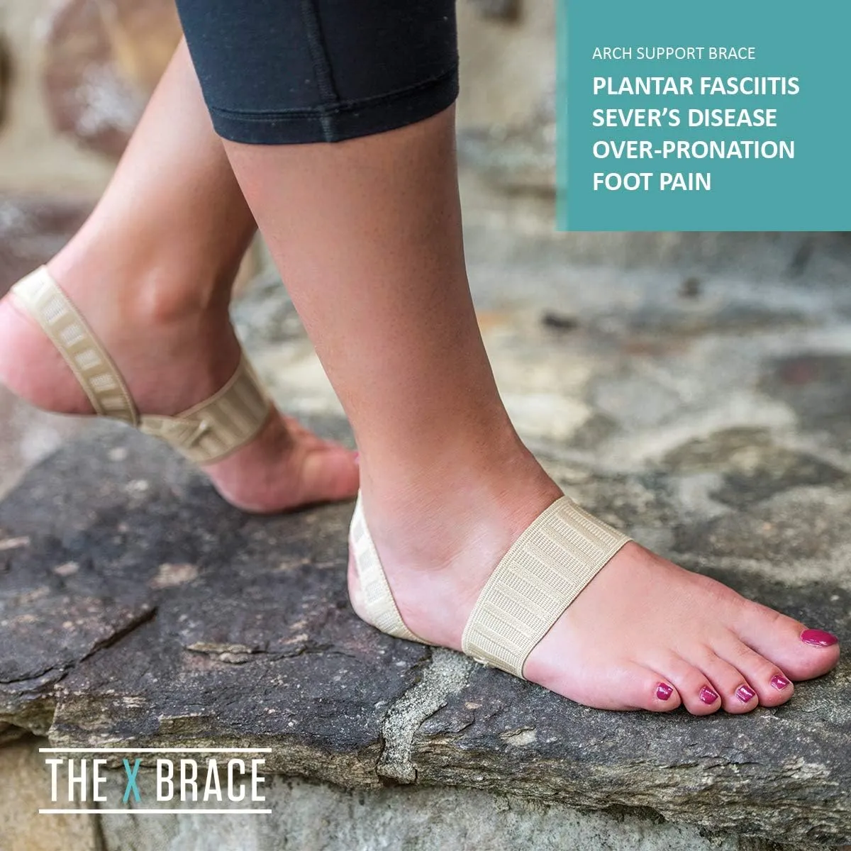 Tuli's X Brace, Arch Support Brace and Compression for Sever's Disease, Plantar Fasciitis, Heel Pain, Flat Feet, Fallen Arches, and Over-Pronation, 1 Pair, X-Small