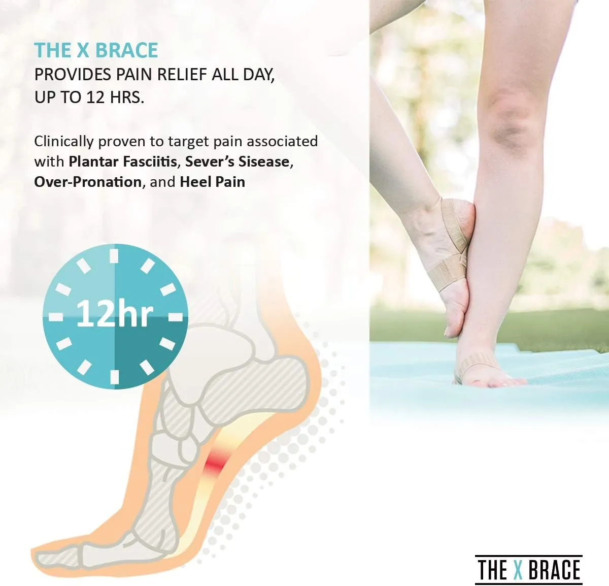 Tuli's X Brace, Arch Support Brace and Compression for Sever's Disease, Plantar Fasciitis, Heel Pain, Flat Feet, Fallen Arches, and Over-Pronation, 1 Pair, X-Small